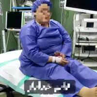 جشنواره لیپوماتیک و ابدو و اسلیو با وام زیبایی