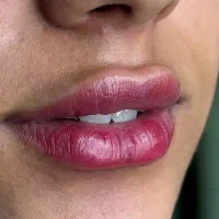 کلینیک لیزر  پوست و مو الیزا