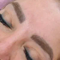 اسکتنشن مژه
