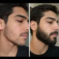 تا کی میخوای بدون ریش باشی