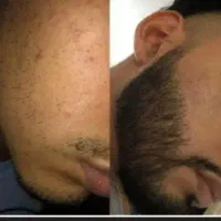 پسر بی ریش کنسله