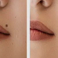 خال