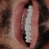 خدمات دندانپزشکی با تعرفه دولتی