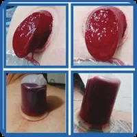 حجامت/بادکش/زالو/ناف گیر/ماساژ درمنــزل شـما