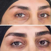 میکروبلیدینگ ابرو،شیدینگ لب،خط چشم و بن مژه