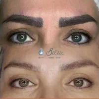 ریموو تخصصی تتو ابرو و خط چشم بدون اسیب به پوست