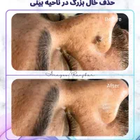 مشاوره رایگان%زگیل تناسلی% آقایان بانوان در اصفهان|خدمات زیبایی و سلامت|اصفهان, مرداویج|دیوار