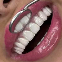 جشنواره خدمات زیبایی و درمان دندان