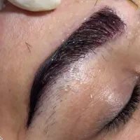 کاشت میکرو ابرو با ضمانت نامه و بیمه تکمیلی