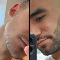 راهکار تخصصی ریش کمپشت