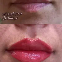 آرایشی