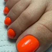 ترمیم دست و پا ((250))