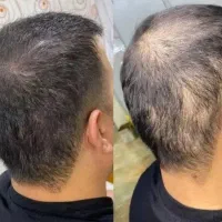 راهکار تقویت رویش تخصصی