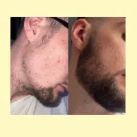 حجم ریشاتو ۳ برابر کن