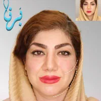 کانتورینگ صورت/زاویه‌سازی و فرم‌دهی نچرال