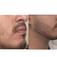 ریش و سبیلات با من میشه جنگل