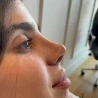 سفیدی صورت