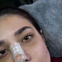 لیفت  و لمینیت ابرو و مژه ،رامسر