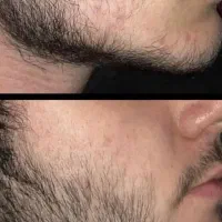 حیف صورتت نیست وقتشه پرش کنی