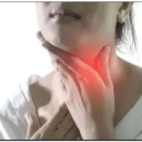 راهنمایی نمونه برداری تیروئید