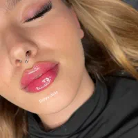 تزریق ژل (فیلر)وبوتاکس لیفت با نخ‌ کانتورینگ