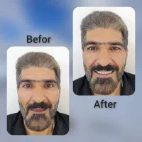 دندانسازی محلات(الماس)
