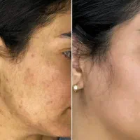 نمایندگی اصلی ضد لک لاکچری کوین اندیشه