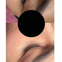 فیشیال تخصصی