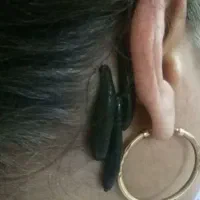 حجامت، زالو درمانی، فصد، حلزون تراپی، بادکش گرم