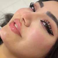 ژل و‌بوتاکس۴۸۰