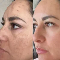 کرم معجزه صورت وکرم عربی دست و پا اصل