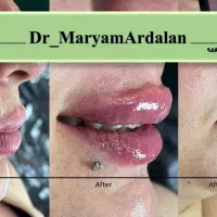 تزریق ژل و بوتاکس و انواع خدمات زیبایی توسط پزشک