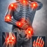 دردمفاصل کلافه ات کرده