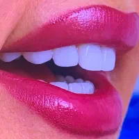 دندانپزشکی ایمپلنت ارتودنسی لمینت کامپوزیت