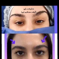 لیفت|خدمات آرایشگری و زیبایی|بروجرد, |دیوار
