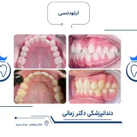 ارتودنسی نامرئی به روش دیجیتالی