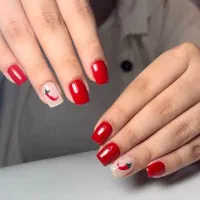 ترمیم ۳۰۰ کاشت ۴۰۰