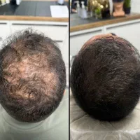 موهات مثل چمن پرپشت میشه
