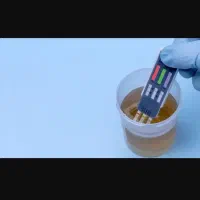 تست تشخیص اعتیاد
