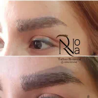 پاک کردن تتو با لیزر/ریموو ابرو/کربن تراپی(پزشک)