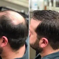 اعتماد به نفس از مو شروع میشه