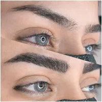 فیبروز میکروبلیدینگ ابرو با تخفیف 80 درصد