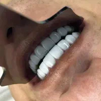 دندانپزشکی با شرایط اقساطی و تخفیف ویژه