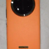 آنر X9C