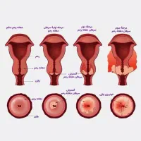 این همه راه نشد این راه انتخاب کن|خدمات آرایشگری و زیبایی|ساری, |دیوار