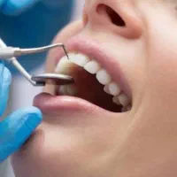 استخدام خانم  دستیار دندانپزشک در درمانگاه معلم