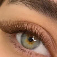 خدمات چشم