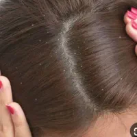 پاکسازی رشک و شپش