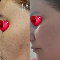پک Vipولوکس اکسیر درخشش وجوانی