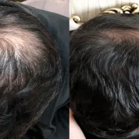 این اشتباه ، ریزش میاره